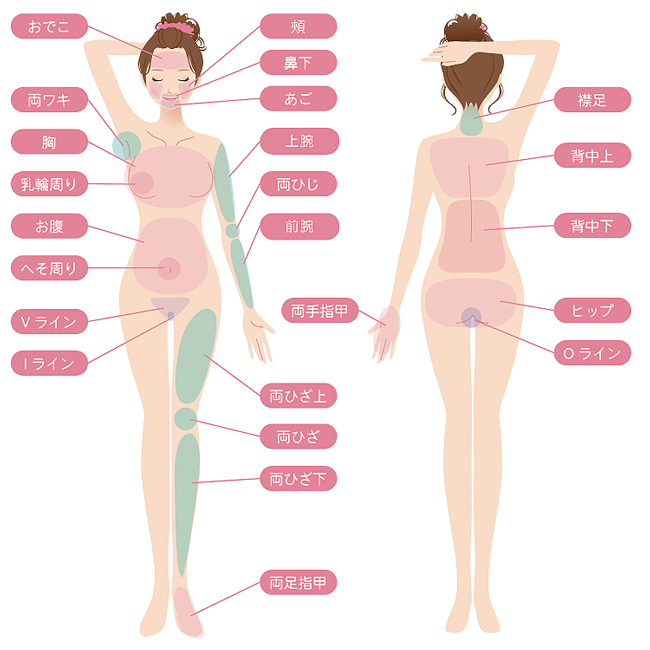 女性脱毛部位
